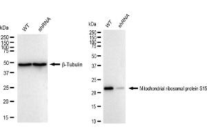 Western blotting analysis using Mitochondrial ribosomal protein S15 antibody (ABIN7799432). (Recombinant MRPS15 抗体)