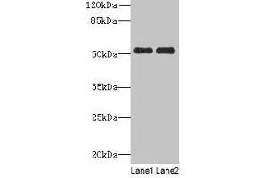 Western blot All lanes: PAH antibody at 2. (Phenylalanine Hydroxylase 抗体  (AA 2-452))