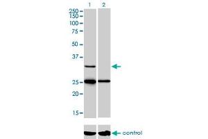 Western blot analysis of STAR over-expressed 293 cell line, cotransfected with STAR Validated Chimera RNAi (Lane 2) or non-transfected control (Lane 1). (STAR 抗体  (AA 81-180))