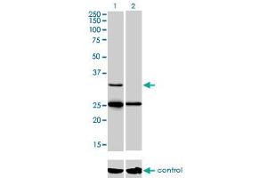 Western blot analysis of STAR over-expressed 293 cell line, cotransfected with STAR Validated Chimera RNAi (Lane 2) or non-transfected control (Lane 1).