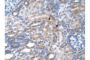 SLC29A2 antibody was used for immunohistochemistry at a concentration of 4-8 ug/ml. (SLC29A2 抗体)