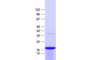 Validation with Western Blot (ZFP69 Protein (His tag))