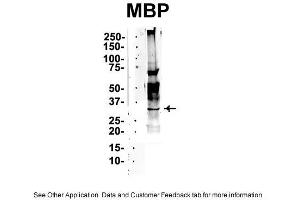 IP Suggested Anti-MBP Antibody Positive Control: NT2 CELL/BRAIN TISSUE (MBP 抗体  (Middle Region))