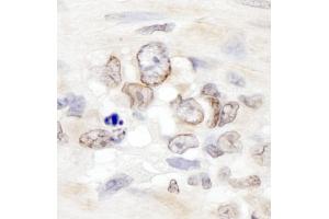 Immunohistochemistry (IHC) image for anti-Achalasia, Adrenocortical Insufficiency, Alacrimia (AAAS) (AA 496-546) antibody (ABIN7455041)