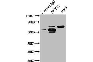 Immunoprecipitating NUP62 in A549 whole cell lysate Lane 1: Rabbit control IgG instead of ABIN7161836 in A549 whole cell lysate. (NUP62 抗体  (AA 173-522))