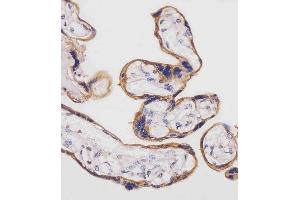 Immunohistochemistry (Paraffin-embedded Sections) (IHC (p)) image for anti-Solute Carrier Family 3 (Activators of Dibasic and Neutral Amino Acid Transport), Member 2 (SLC3A2) (AA 588-615), (C-Term) antibody (ABIN654111)