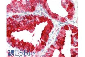 ABIN5539546 (5µg/ml) staining of paraffin embedded Human Prostate.