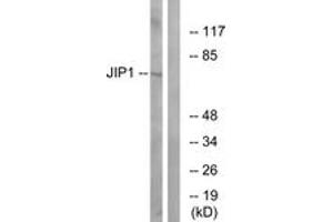 Western blot analysis of extracts from COLO205 cells, treated with Serum 20% 15', using JIP1 (Ab-103) Antibody. (MAPK8IP1 抗体  (AA 69-118))