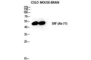 Western Blotting (WB) image for anti-Serum Response Factor (SRF) (Tyr1197) antibody (ABIN3180896) (SRF 抗体  (Tyr1197))