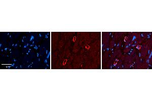 Rabbit Anti-GRP78 Antibody   Formalin Fixed Paraffin Embedded Tissue: Human heart Tissue Observed Staining: Cytoplasmic Primary Antibody Concentration: 1:100 Other Working Concentrations: 1:600 Secondary Antibody: Donkey anti-Rabbit-Cy3 Secondary Antibody Concentration: 1:200 Magnification: 20X Exposure Time: 0. (GRP78 抗体  (C-Term))