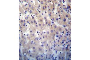 HPRT1 Antibody (N-term) (ABIN652234 and ABIN2840981) immunohistochemistry analysis in formalin fixed and paraffin embedded human liver tissue followed by peroxidase conjugation of the secondary antibody and DAB staining. (HPRT1 抗体  (N-Term))