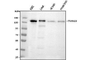 Western blot analysis of TIF1 gamma using anti-TIF1 gamma antibody (ABIN3043492). (TRIM33 抗体  (AA 1001-1127))