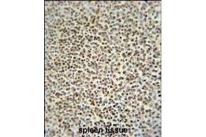 Immunohistochemistry (Paraffin-embedded Sections) (IHC (p)) image for anti-Zinc Finger CCCH-Type Containing 12A (ZC3H12A) (AA 331-358) antibody (ABIN654931)