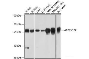ATP6V1B2 抗体