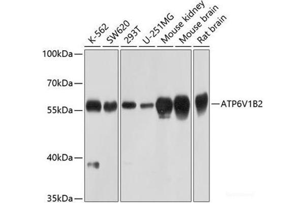 ATP6V1B2 抗体
