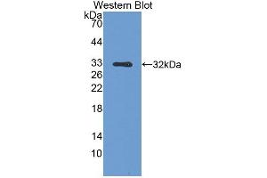 Detection of recombinant SPR using Polyclonal Antibody to Sepiapterin Reductase (SPR) (SPR 抗体  (AA 1-261))