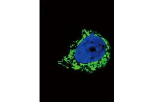 Immunofluorescence (IF) image for anti-Insulin-Like Growth Factor Binding Protein 2, 36kDa (IGFBP2) antibody (ABIN3003819) (IGFBP2 抗体)