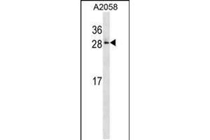 Western blot analysis in A2058 cell line lysates (35ug/lane). (RAB28 抗体  (AA 119-147))