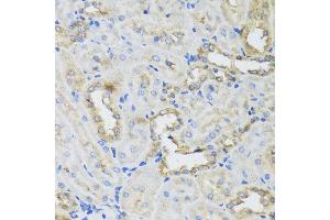 Immunohistochemistry of paraffin-embedded rat kidney using AHCYL1 antibody at dilution of 1:100 (x40 lens). (AHCYL1 抗体)