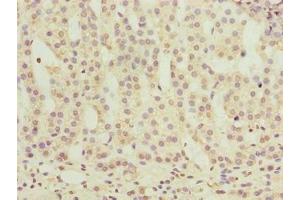 Immunohistochemistry (IHC) image for anti-Olfactory Receptor 2H1 (OR2H1) (AA 157-193) antibody (ABIN7162175)