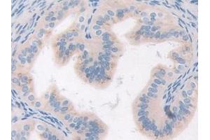 Immunohistochemistry (IHC) image for anti-Macrophage Stimulating 1 Receptor (C-Met-Related tyrosine Kinase) (MST1R) (AA 89-275) antibody (ABIN7440278)
