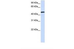 Image no. 1 for anti-Uridine Monophosphate Synthetase (UMPS) (AA 398-447) antibody (ABIN6738421) (UMPS 抗体  (AA 398-447))