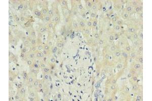 Immunohistochemistry of paraffin-embedded human liver using ABIN7148699 in 30 μg/mL dilute concentrations. (CRP 抗体)