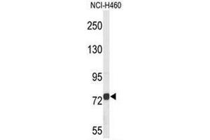 Western blot analysis of CHAT Antibody (N-term) in NCI-H460 cell line lysates (35µg/lane). (Choline Acetyltransferase 抗体  (N-Term))