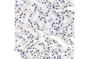 Immunohistochemistry (IHC) image for anti-Sp1 Transcription Factor (SP1) antibody (ABIN7270505)