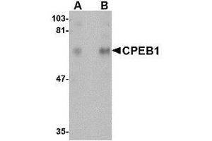 Western blot analysis of CPEB1 in rat brain tissue lysate with AP30241PU-N CPEB1 antibody at (A) 1 and (B) 2 μg/ml. (CPEB1 抗体  (N-Term))