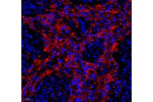 Immunofluorescence of paraffin embedded human colon using LRP (ABIN7074548) at dilution of 1: 250 (400x lens) (MVP 抗体)
