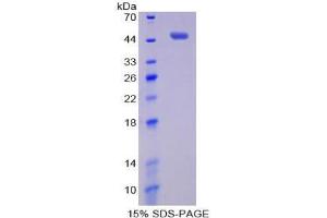 SDS-PAGE analysis of Human Pim-1 Oncogene Protein. (PIM1 蛋白)