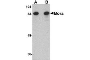 Western blot analysis of Bora in Jurkat cell lysate with AP30162PU-N Bora antibody at (A) 1 and (B) 2 μg/ml. (BORA 抗体  (N-Term))