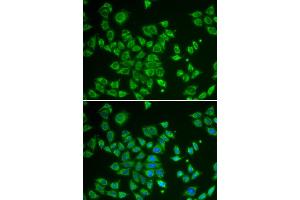 Immunofluorescence analysis of HeLa cells using SMAD1 antibody. (SMAD1 抗体)