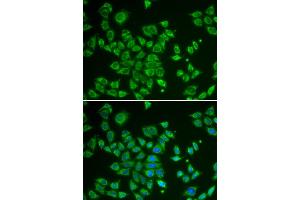 Immunofluorescence analysis of HeLa cells using SMAD1 antibody. (SMAD1 抗体)