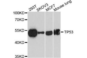 Western Blotting (WB) image for anti-Tumor Protein P53 (TP53) antibody (ABIN4905467)