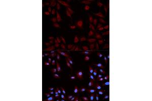 Immunofluorescence analysis of HeLa cell using STAT5B antibody. (STAT5B 抗体  (AA 40-280))