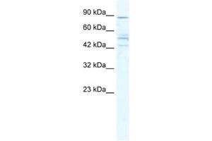 Western Blotting (WB) image for anti-Cholinergic Receptor, Nicotinic, beta 2 (Neuronal) (CHRNB2) antibody (ABIN2461570) (CHRNB2 抗体)