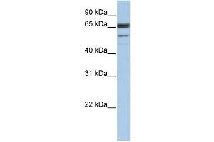 WB Suggested Anti-SEPN1 Antibody Titration:  1 ug/ml  Positive Control:  Hela cell lysate (SEPN1 抗体  (C-Term))