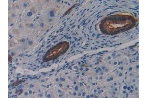 Immunohistochemistry (IHC) image for anti-Lipolysis Stimulated Lipoprotein Receptor (LSR) (AA 335-589) antibody (ABIN7435571)