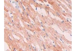 Detection of Slit1 in Rat Heart Tissue using Polyclonal Antibody to Slit Homolog 1 (Slit1) (SLIT1 抗体  (AA 308-512))