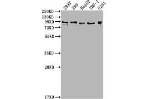 Western Blot Positive WB detected in: 293T whole cell lysate, 293 whole cell lysate, HepG2 whole cell lysate, THP-1 whole cell lysate, U251 whole cell lysate All lanes: CCHCR1 antibody at 1:2000 Secondary Goat polyclonal to rabbit IgG at 1/50000 dilution Predicted band size: 89, 100, 96 kDa Observed band size: 89 kDa (CCHCR1 抗体  (AA 281-500))