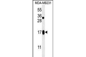 C4orf34 Antibody (C-term) (ABIN651629 and ABIN2840335) western blot analysis in MDA-M cell line lysates (35 μg/lane). (SMIM14 抗体  (C-Term))