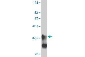 Western Blot detection against Immunogen (33. (MEF2B 抗体  (AA 165-235))