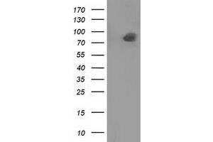 Western Blotting (WB) image for anti-Protein tyrosine Phosphatase, Receptor Type, E (PTPRE) antibody (ABIN1500508) (PTPRE 抗体)
