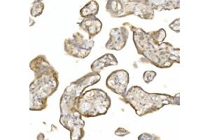 IHC analysis of LY6E/SCA-2 using anti-LY6E/SCA-2 antibody (ABIN7600591).