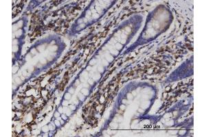 Immunostaining (ISt) image for anti-Aldo-Keto Reductase Family 1, Member B1 (Aldose Reductase) (AKR1B1) (AA 1-316) antibody (ABIN513262)