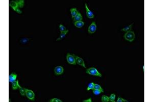 Immunofluorescent analysis of HepG2 cells using ABIN7158656 at dilution of 1:100 and Alexa Fluor 488-congugated AffiniPure Goat Anti-Rabbit IgG(H+L)