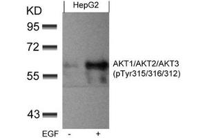 Western blot analysis of extracts from HepG2 cells untreated or treated with EGF using AKT1/AKT2/AKT3(phospho-Tyr315/316/312) Antibody. (AKT 1/2/3 抗体  (pTyr312, pTyr315, pTyr316))