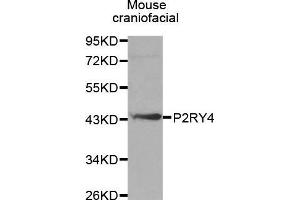 Western Blotting (WB) image for anti-Pyrimidinergic Receptor P2Y, G-Protein Coupled, 4 (P2RY4) (AA 286-365) antibody (ABIN3017282) (P2RY4 抗体  (AA 286-365))